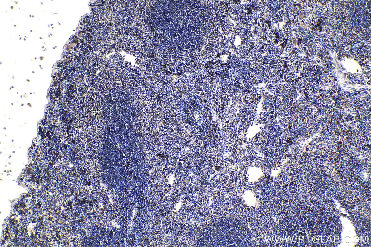 Immunohistochemistry (IHC) staining of mouse spleen tissue using RUNX3 Polyclonal antibody (27099-1-AP)