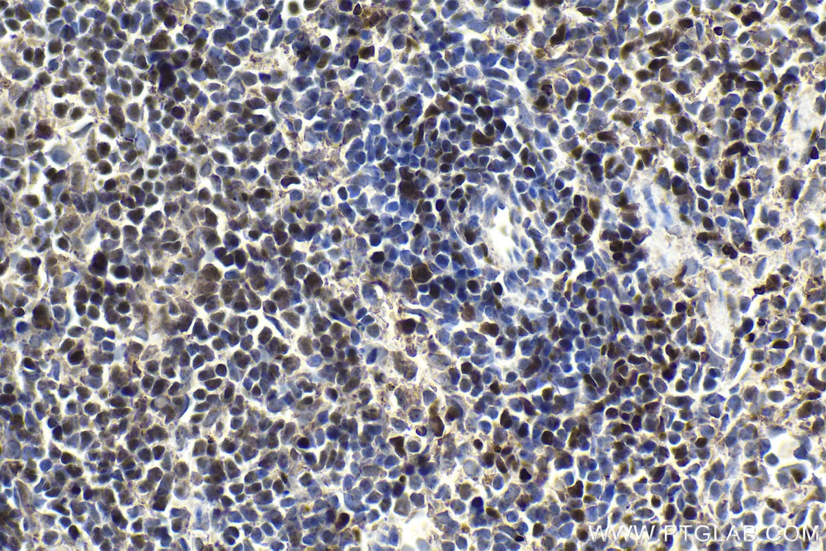 Immunohistochemistry (IHC) staining of mouse spleen tissue using RUNX3 Polyclonal antibody (27099-1-AP)