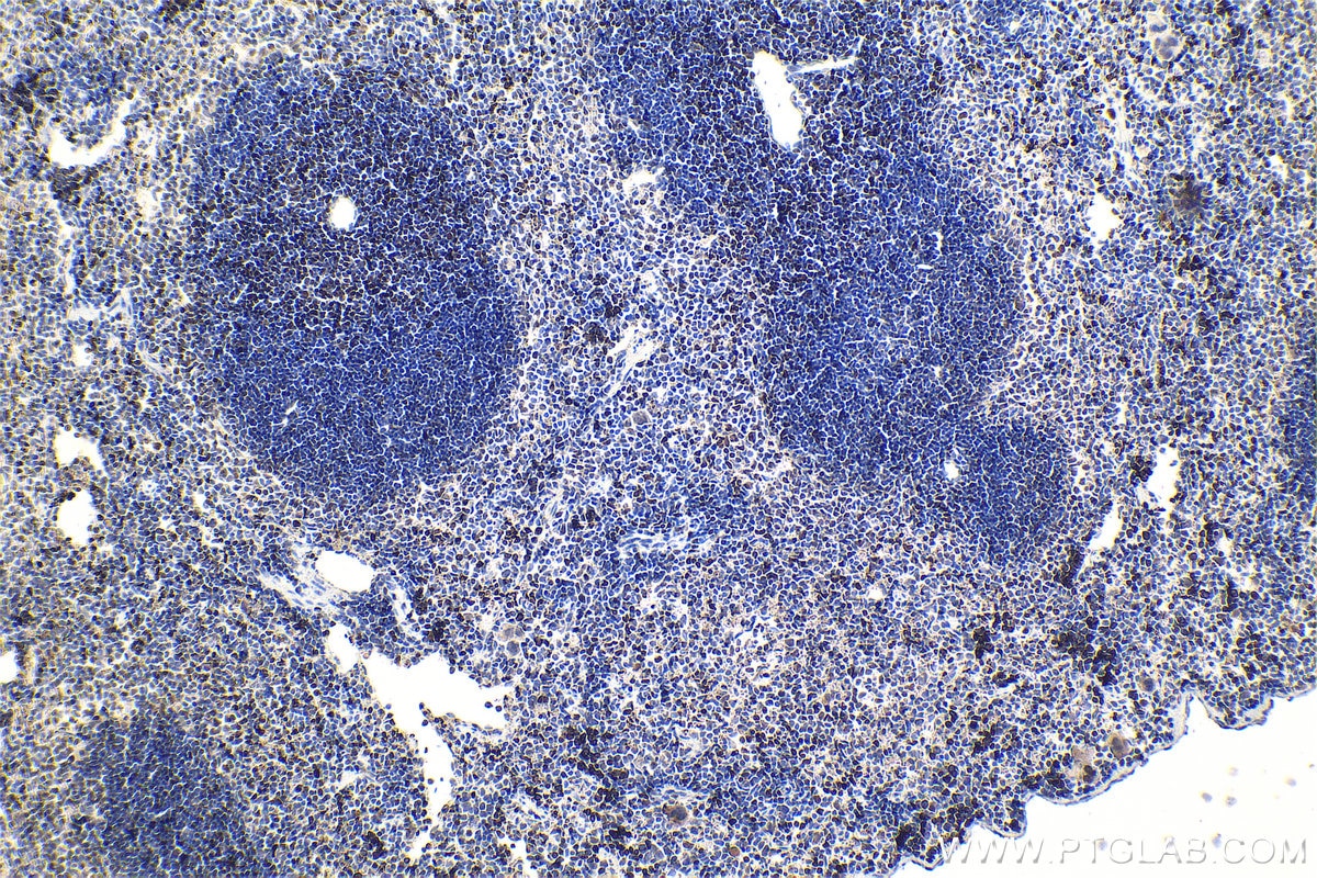 IHC staining of mouse spleen using 27099-1-AP Immunohistochemistry (IHC) staining of mouse spleen tissue using RUNX3 Polyclonal antibody (27099-1-AP)