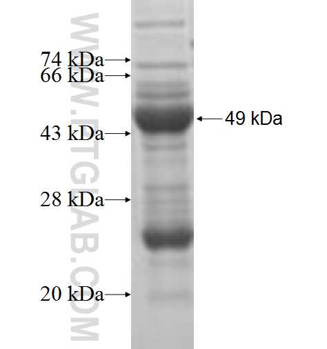 RUSC1 fusion protein Ag5815 SDS-PAGE
