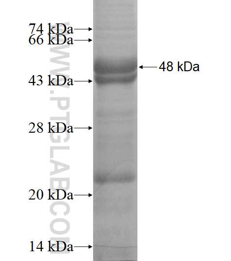 RUSC2 fusion protein Ag15541 SDS-PAGE