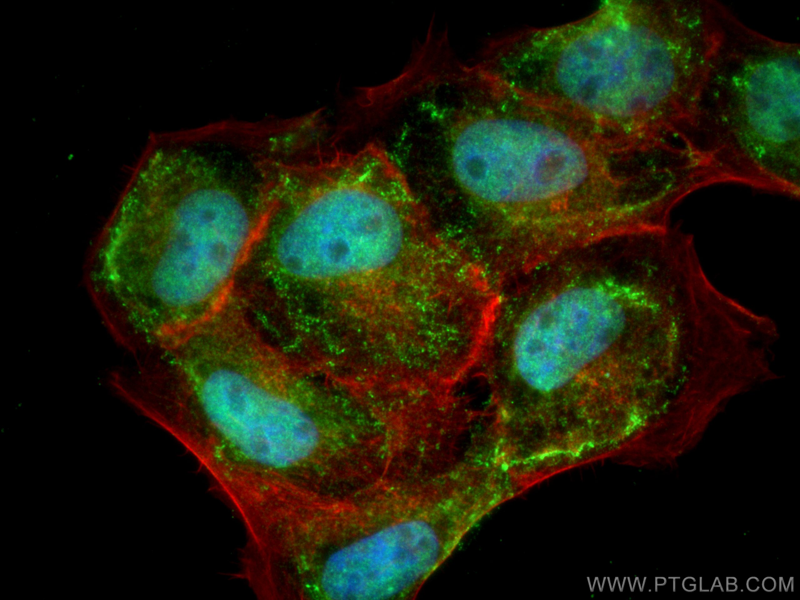 Immunofluorescence (IF) / fluorescent staining of A431 cells using RUVBL1 Polyclonal antibody (10210-2-AP)