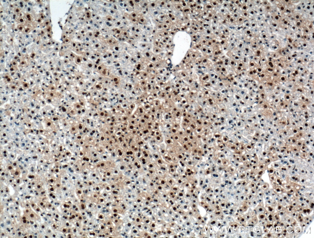 Immunohistochemistry (IHC) staining of mouse liver tissue using RUVBL1 Polyclonal antibody (10210-2-AP)