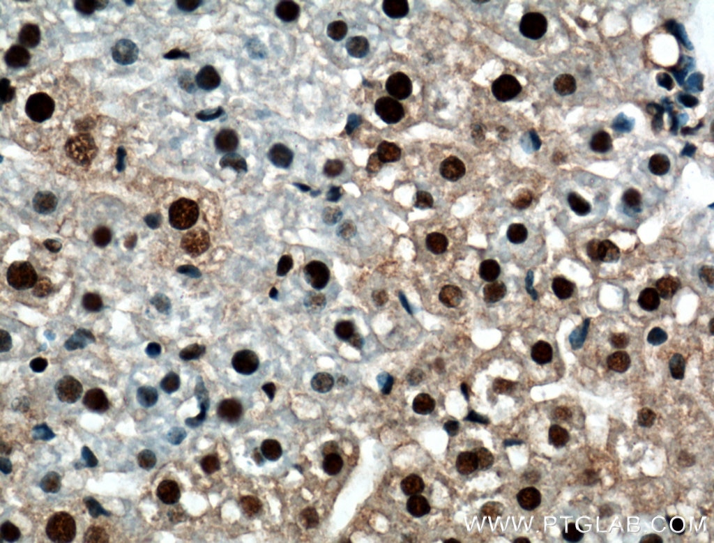 Immunohistochemistry (IHC) staining of mouse liver tissue using RUVBL1 Polyclonal antibody (10210-2-AP)