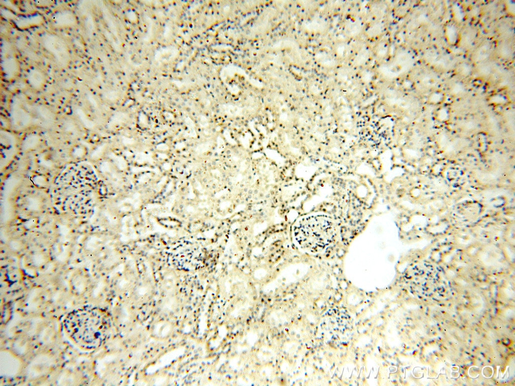IHC staining of human kidney using 60032-1-Ig