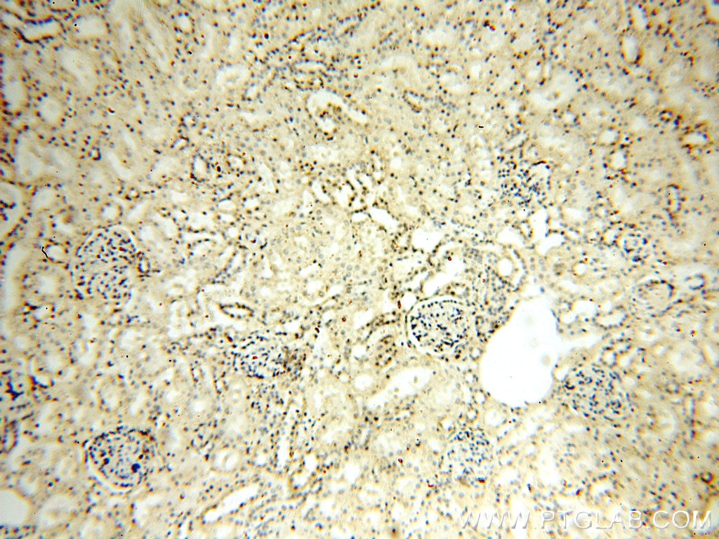 Immunohistochemistry (IHC) staining of human kidney tissue using RUVBL1 Monoclonal antibody (60032-1-Ig)