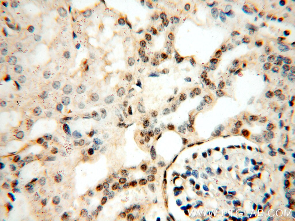 Immunohistochemistry (IHC) staining of human kidney tissue using RUVBL1 Monoclonal antibody (60032-1-Ig)