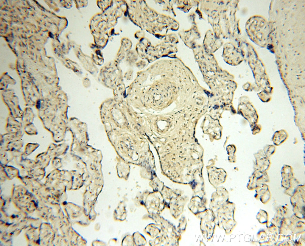 IHC staining of human placenta using 60032-1-Ig
