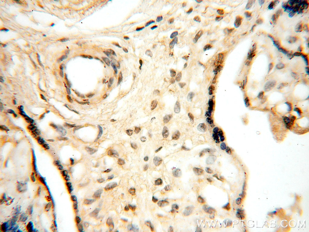 Immunohistochemistry (IHC) staining of human placenta tissue using RUVBL1 Monoclonal antibody (60032-1-Ig)