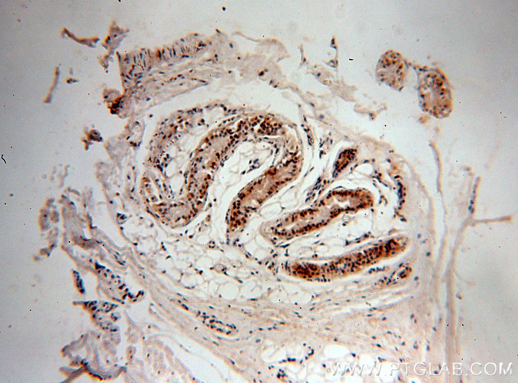 Immunohistochemistry (IHC) staining of human skin tissue using RUVBL1 Monoclonal antibody (60032-1-Ig)