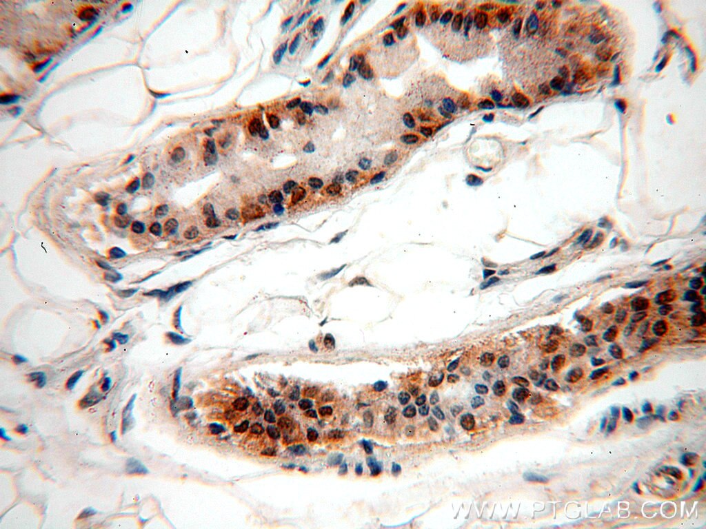 Immunohistochemistry (IHC) staining of human skin tissue using RUVBL1 Monoclonal antibody (60032-1-Ig)