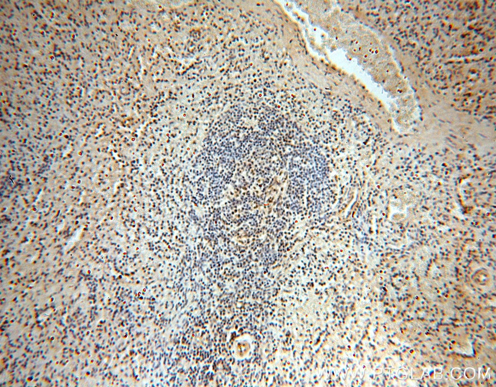 Immunohistochemistry (IHC) staining of human spleen tissue using RUVBL1 Monoclonal antibody (60032-1-Ig)