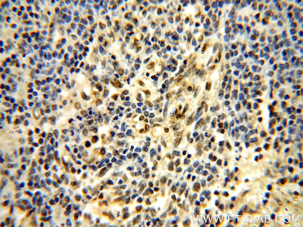 Immunohistochemistry (IHC) staining of human spleen tissue using RUVBL1 Monoclonal antibody (60032-1-Ig)