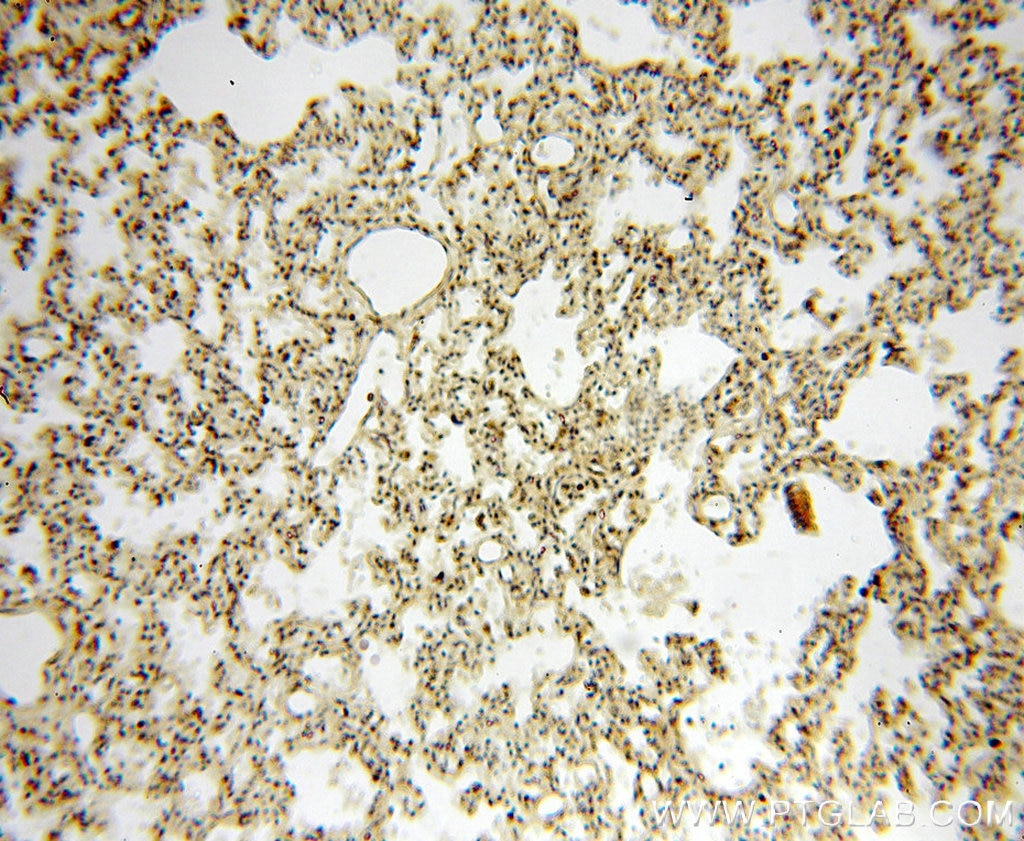 Immunohistochemistry (IHC) staining of human lung tissue using RUVBL1 Monoclonal antibody (60032-1-Ig)