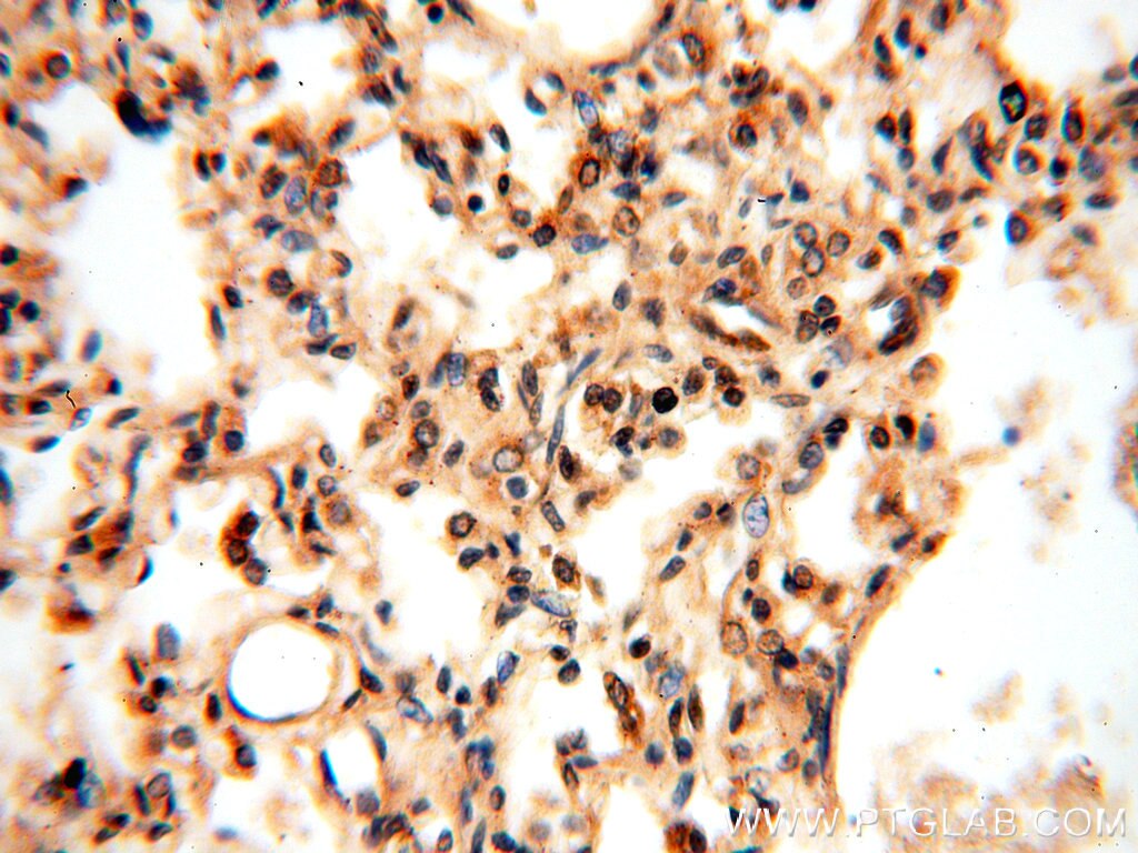 Immunohistochemistry (IHC) staining of human lung tissue using RUVBL1 Monoclonal antibody (60032-1-Ig)