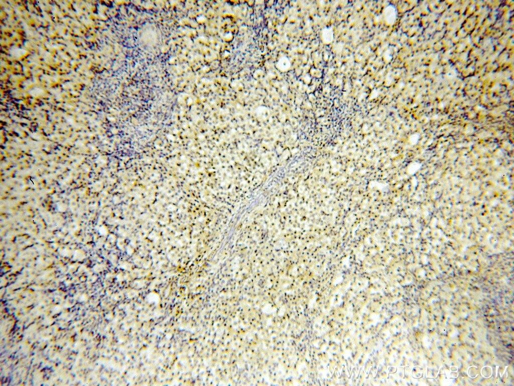 IHC staining of human ovary using 60032-1-Ig