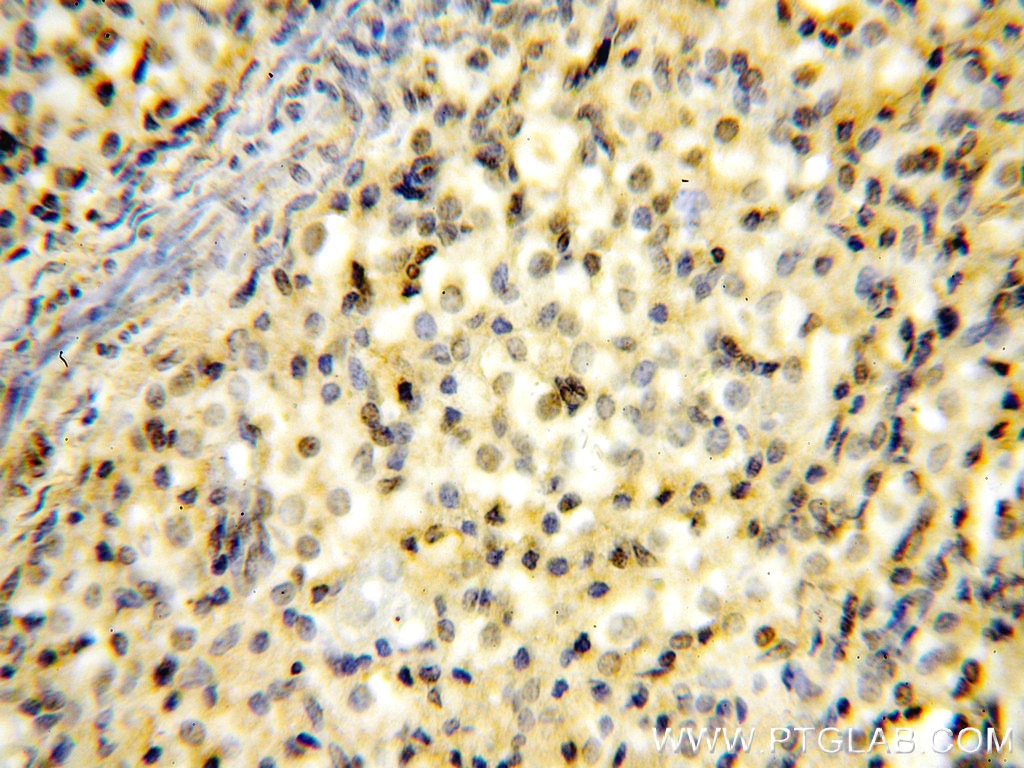 Immunohistochemistry (IHC) staining of human ovary tissue using RUVBL1 Monoclonal antibody (60032-1-Ig)