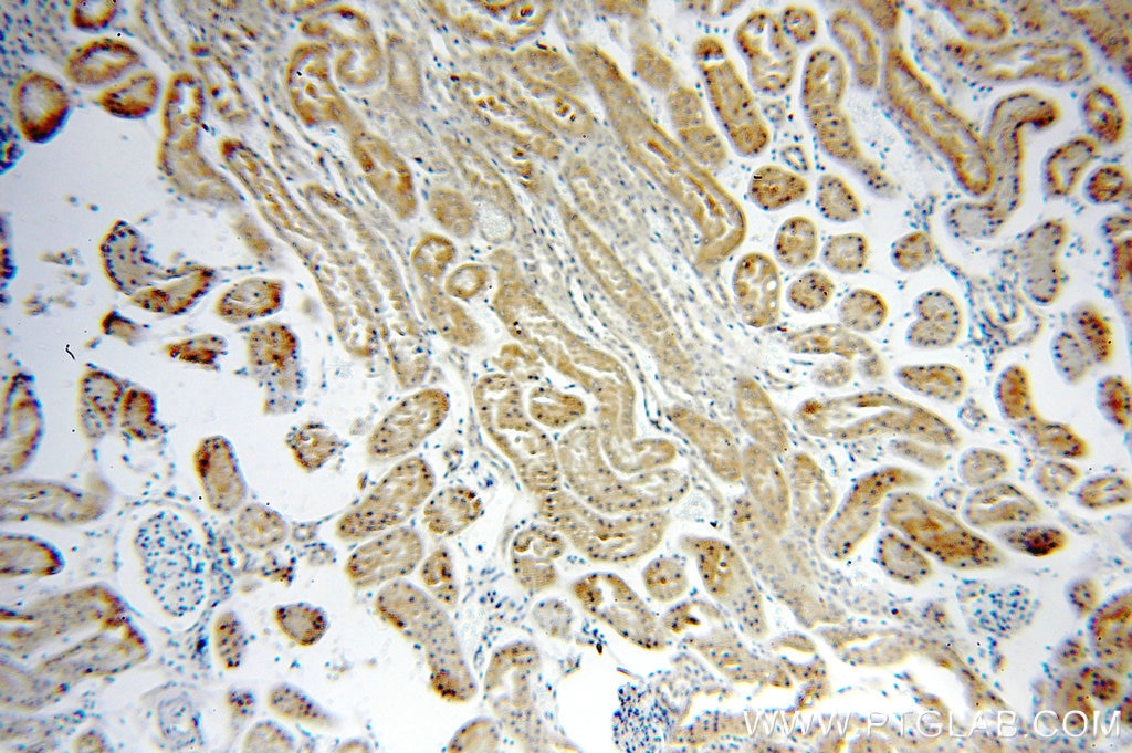 Immunohistochemistry (IHC) staining of human kidney tissue using RUVBL1 Monoclonal antibody (60032-1-Ig)