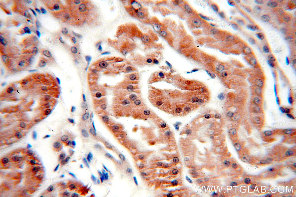 Immunohistochemistry (IHC) staining of human kidney tissue using RUVBL1 Monoclonal antibody (60032-1-Ig)
