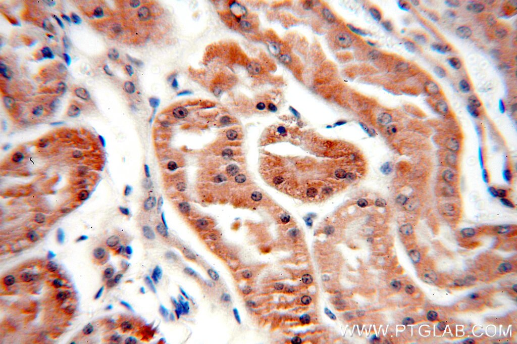 IHC staining of human kidney using 60032-1-Ig