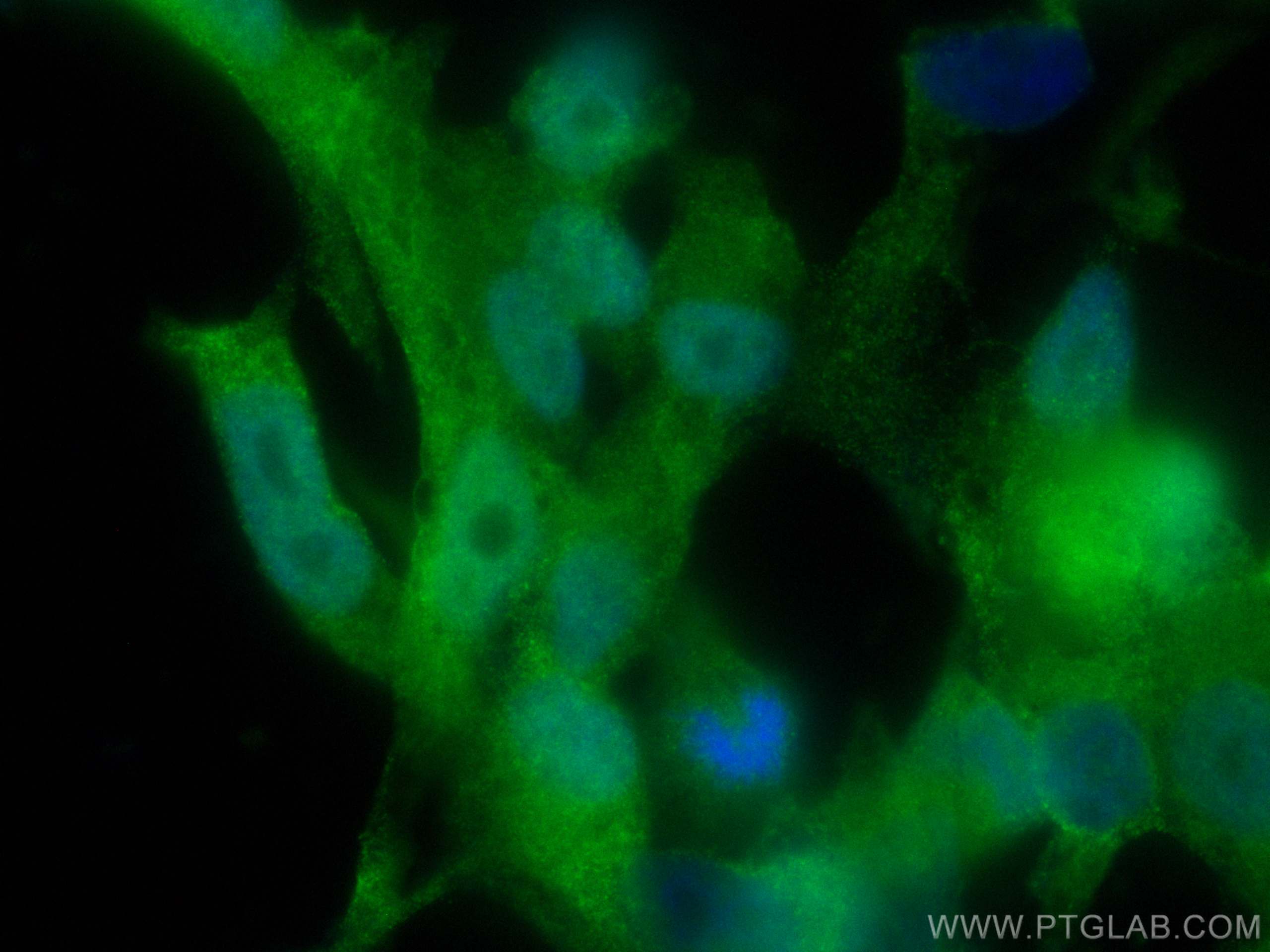 Immunofluorescence (IF) / fluorescent staining of LNCaP cells using CoraLite® Plus 488-conjugated RUVBL1 Monoclonal an (CL488-67750)