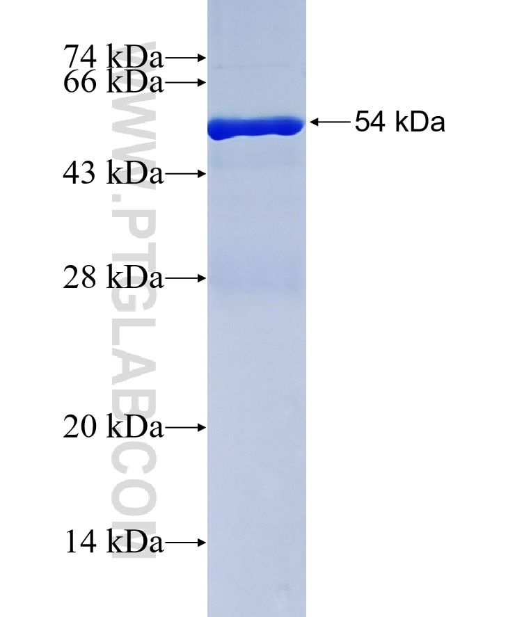 RUVBL1 fusion protein Ag0281 SDS-PAGE