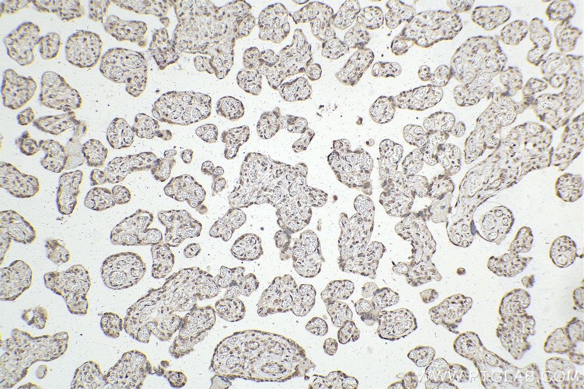 Immunohistochemistry (IHC) staining of human placenta tissue using RUVBL2 Polyclonal antibody (10195-1-AP)