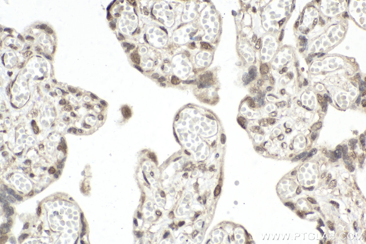 Immunohistochemistry (IHC) staining of human placenta tissue using RUVBL2 Polyclonal antibody (10195-1-AP)