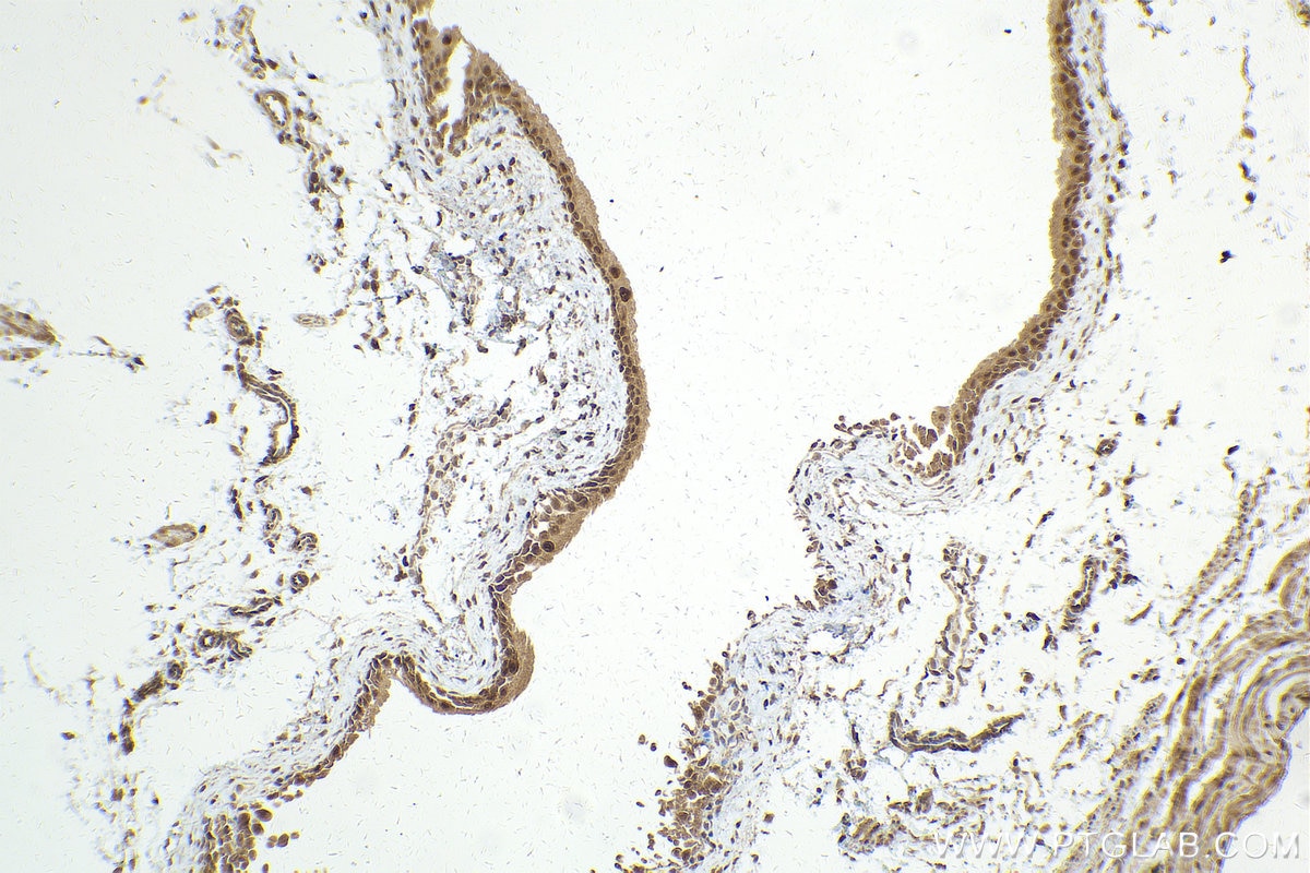 Immunohistochemistry (IHC) staining of mouse bladder tissue using RUVBL2 Polyclonal antibody (10195-1-AP)