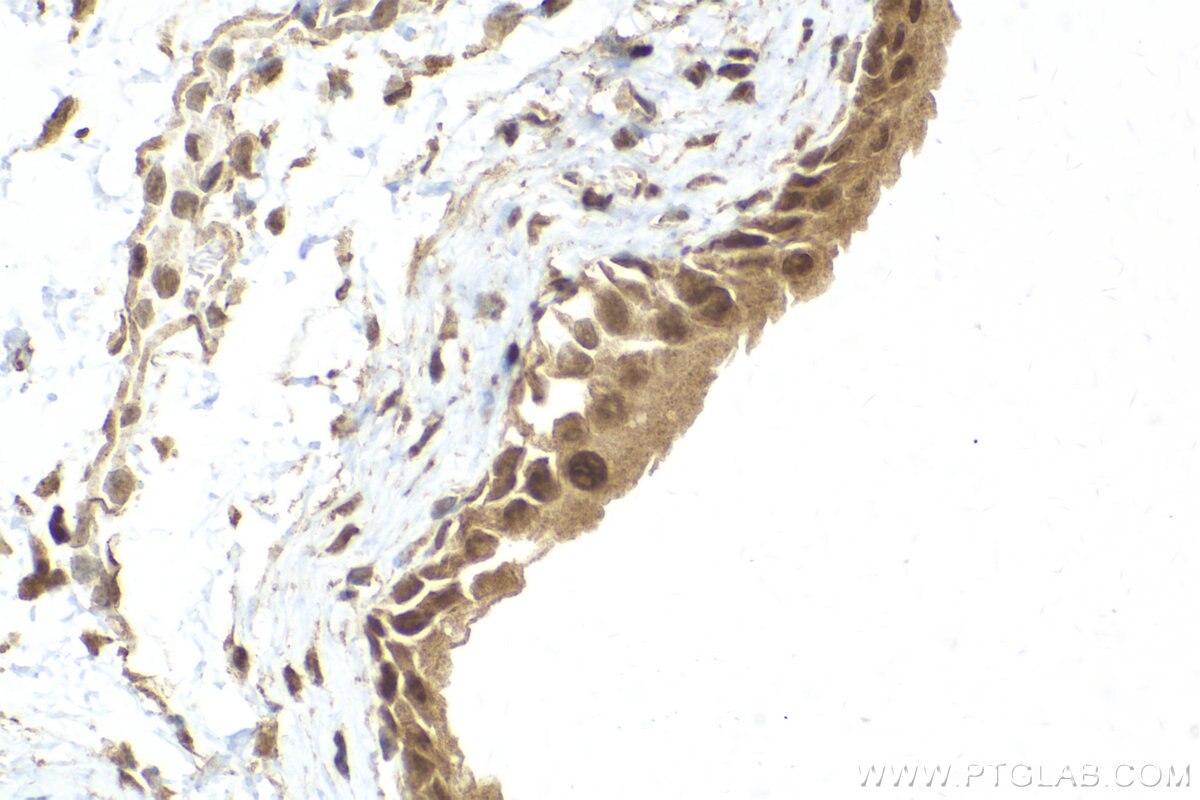 Immunohistochemistry (IHC) staining of mouse bladder tissue using RUVBL2 Polyclonal antibody (10195-1-AP)