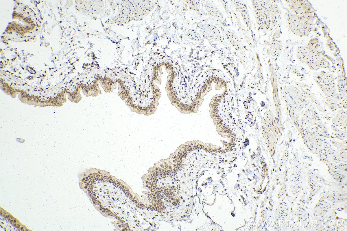 Immunohistochemistry (IHC) staining of rat bladder tissue using RUVBL2 Polyclonal antibody (10195-1-AP)