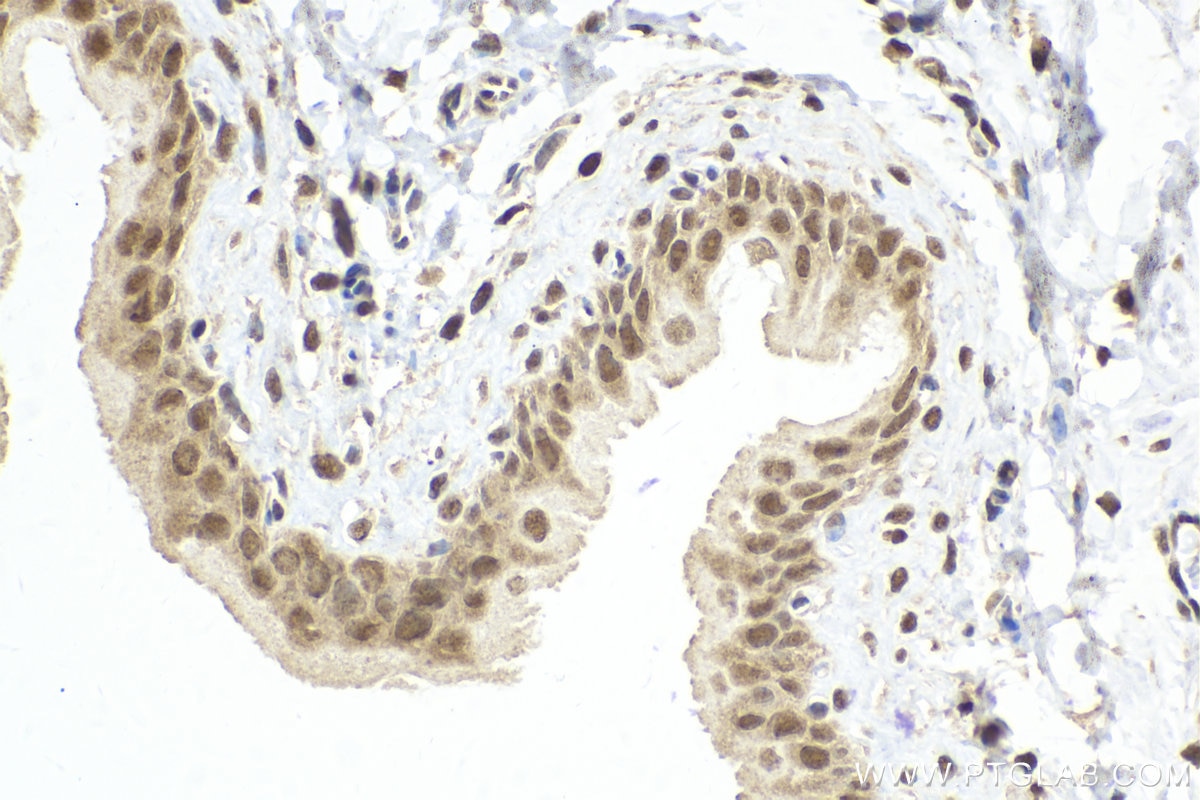 Immunohistochemistry (IHC) staining of rat bladder tissue using RUVBL2 Polyclonal antibody (10195-1-AP)