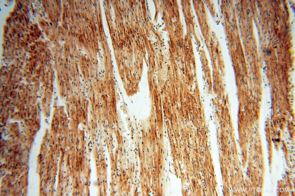 Immunohistochemistry (IHC) staining of human heart tissue using RUVBL2 Polyclonal antibody (10195-1-AP)