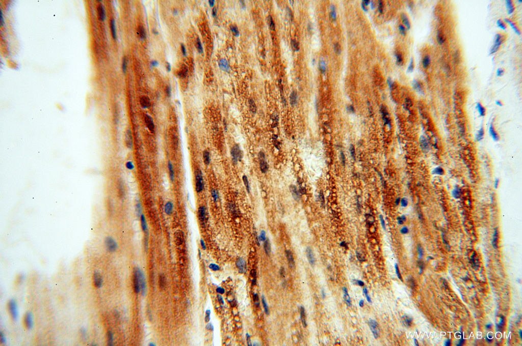 Immunohistochemistry (IHC) staining of human heart tissue using RUVBL2 Polyclonal antibody (10195-1-AP)