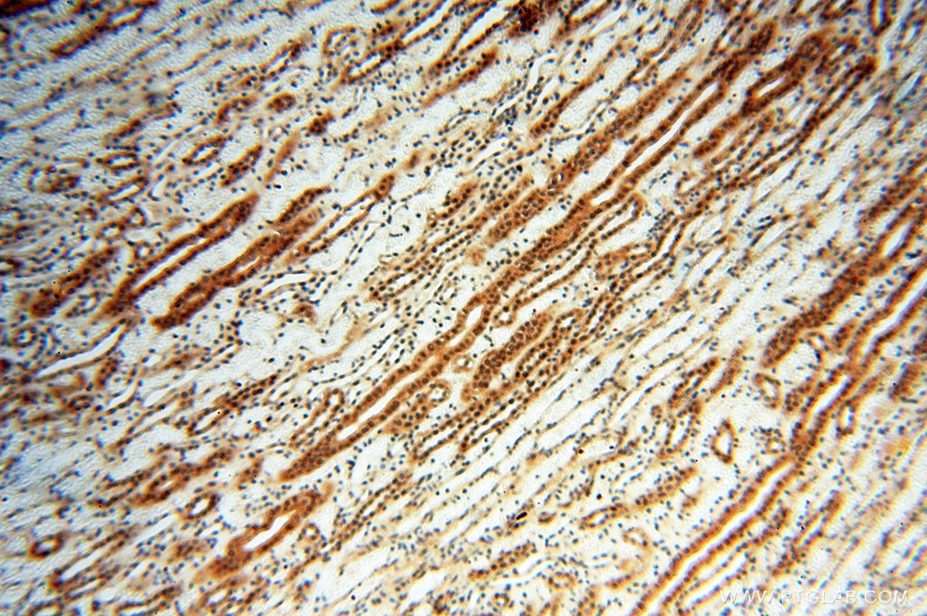 IHC staining of human kidney using 10195-1-AP