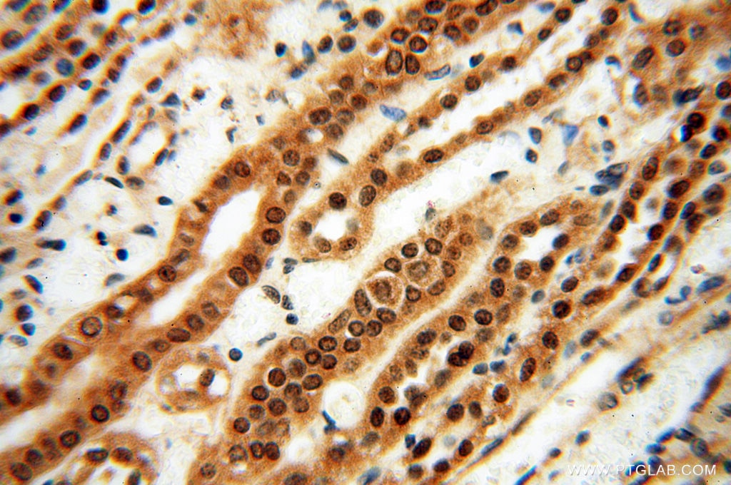 IHC staining of human kidney using 10195-1-AP