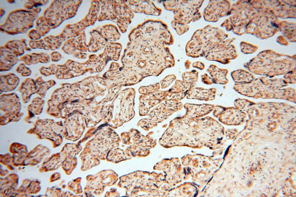 Immunohistochemistry (IHC) staining of human placenta tissue using RUVBL2 Polyclonal antibody (10195-1-AP)