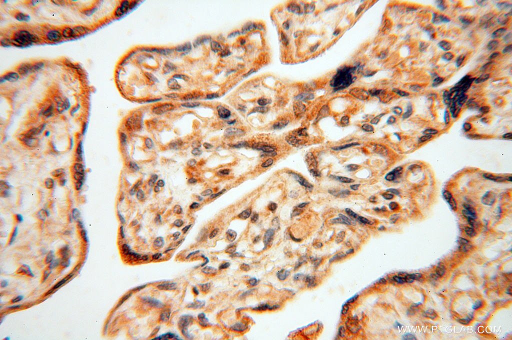 Immunohistochemistry (IHC) staining of human placenta tissue using RUVBL2 Polyclonal antibody (10195-1-AP)