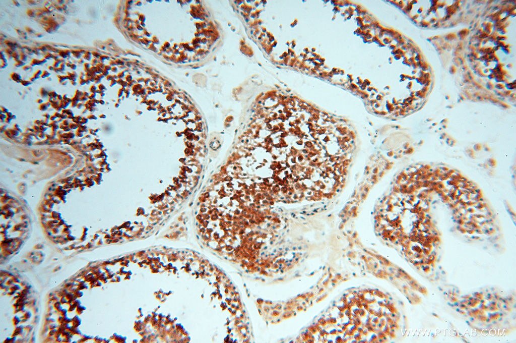 IHC staining of human testis using 10195-1-AP