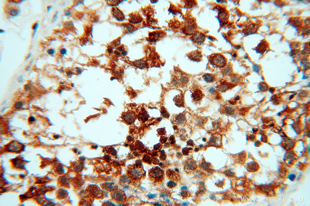 Immunohistochemistry (IHC) staining of human testis tissue using RUVBL2 Polyclonal antibody (10195-1-AP)