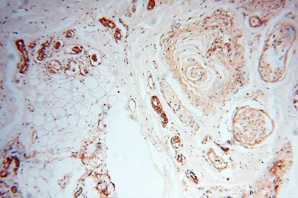 Immunohistochemistry (IHC) staining of human skin tissue using RUVBL2 Polyclonal antibody (10195-1-AP)