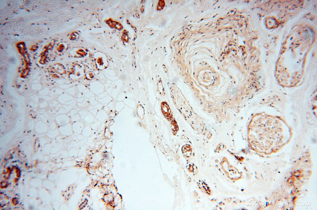 IHC staining of human skin using 10195-1-AP