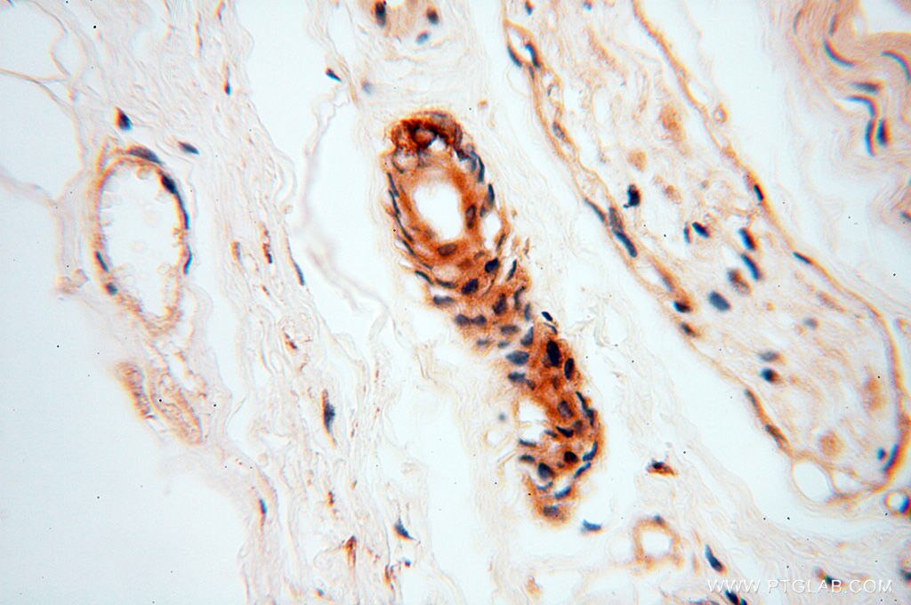 Immunohistochemistry (IHC) staining of human skin tissue using RUVBL2 Polyclonal antibody (10195-1-AP)