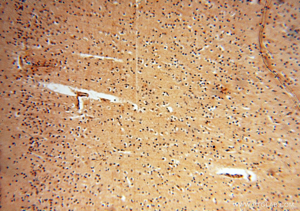Immunohistochemistry (IHC) staining of human brain tissue using RUVBL2 Polyclonal antibody (10195-1-AP)