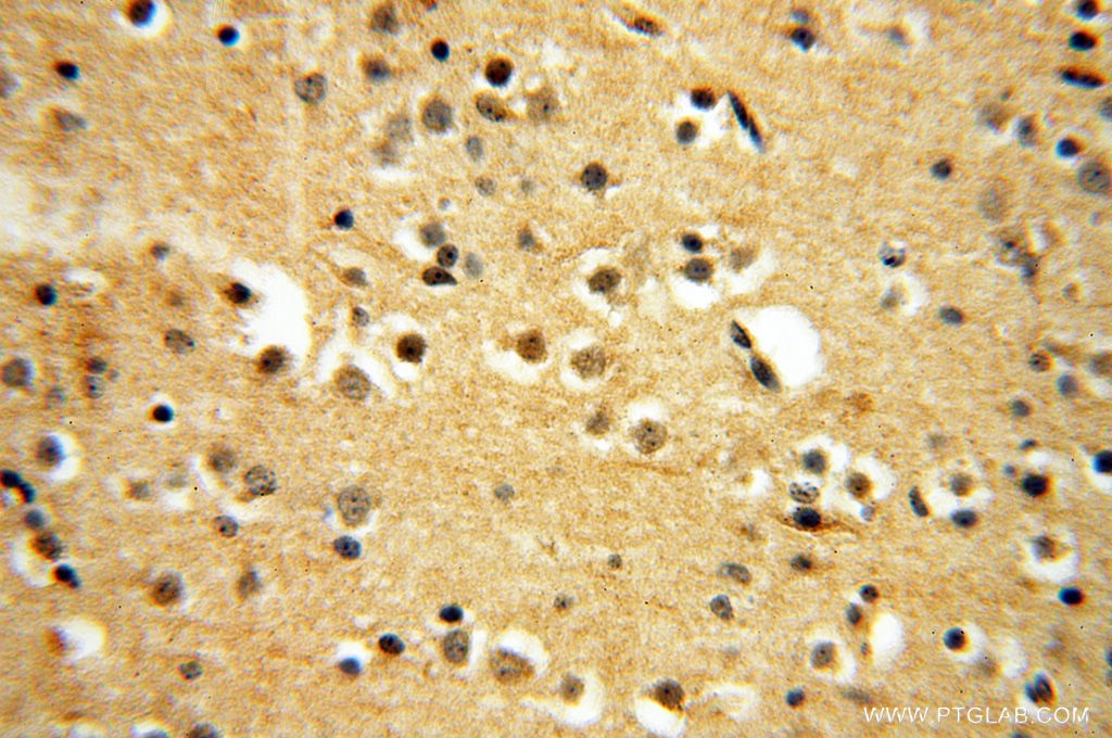 IHC staining of human brain using 10195-1-AP