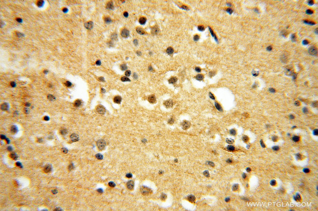 Immunohistochemistry (IHC) staining of human brain tissue using RUVBL2 Polyclonal antibody (10195-1-AP)