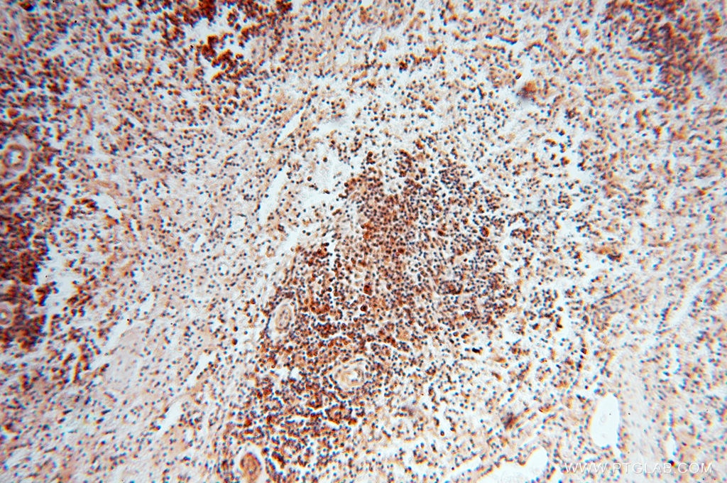 Immunohistochemistry (IHC) staining of human spleen tissue using RUVBL2 Polyclonal antibody (10195-1-AP)