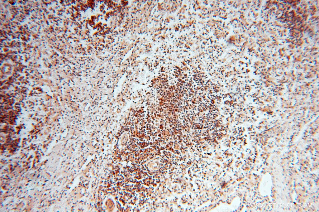 IHC staining of human spleen using 10195-1-AP