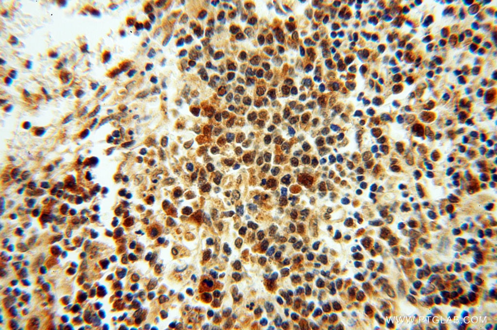 Immunohistochemistry (IHC) staining of human spleen tissue using RUVBL2 Polyclonal antibody (10195-1-AP)
