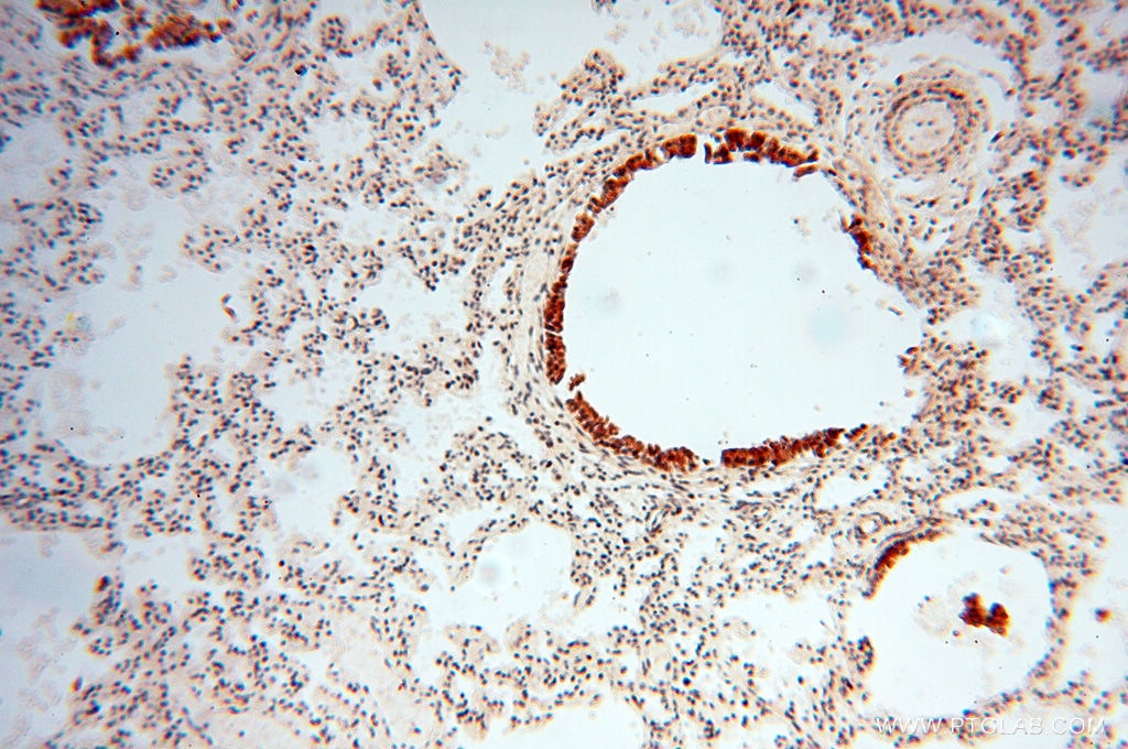Immunohistochemistry (IHC) staining of human lung tissue using RUVBL2 Polyclonal antibody (10195-1-AP)